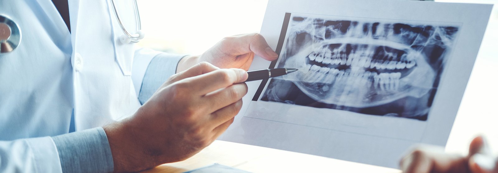 xray of teeth